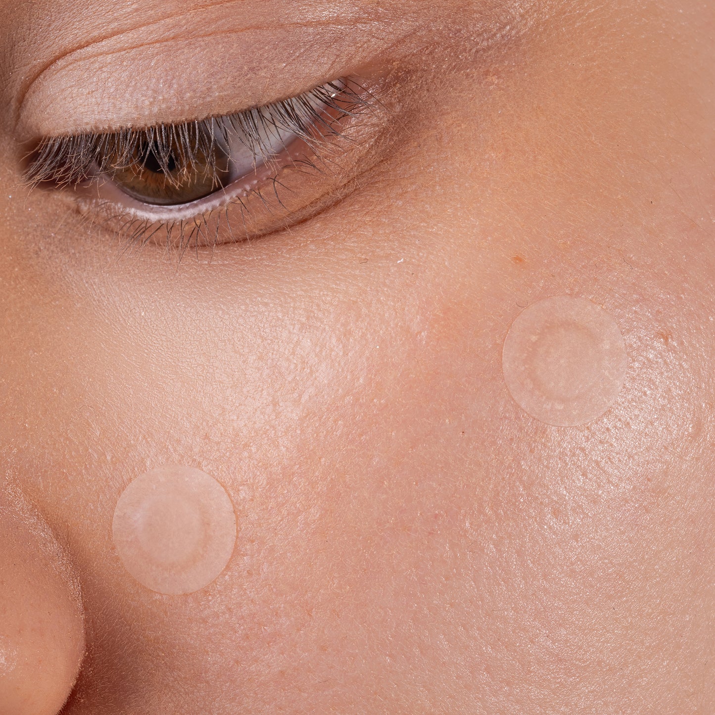 Spot the F Off Invisible Blemish Patches